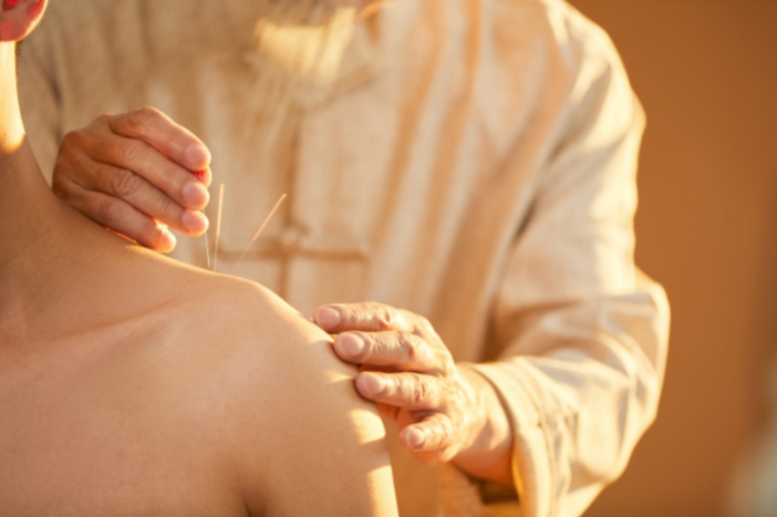 Why Is Acupuncture Become Popular in Australia?